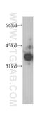 ELMO Domain Containing 1 antibody, 12761-1-AP, Proteintech Group, Western Blot image 