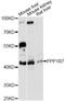 Protein Phosphatase 1 Regulatory Subunit 7 antibody, LS-C748107, Lifespan Biosciences, Western Blot image 