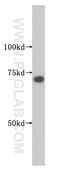 Smoothelin-like protein 2 antibody, 14782-1-AP, Proteintech Group, Western Blot image 
