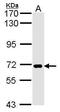 Pit1 antibody, PA5-28182, Invitrogen Antibodies, Western Blot image 