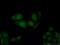 Protein MCM10 homolog antibody, 12251-1-AP, Proteintech Group, Immunofluorescence image 