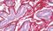 Periostin antibody, MBS248446, MyBioSource, Immunohistochemistry paraffin image 