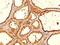 Thyroglobulin antibody, NBP2-45119, Novus Biologicals, Immunohistochemistry paraffin image 