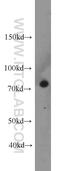 Calpain 1 antibody, 10538-1-AP, Proteintech Group, Western Blot image 