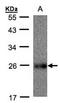 Ubiquinol-Cytochrome C Reductase, Rieske Iron-Sulfur Polypeptide 1 antibody, orb73620, Biorbyt, Western Blot image 