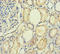 PLA2-R antibody, LS-C371409, Lifespan Biosciences, Immunohistochemistry paraffin image 