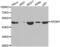 AP-2 complex subunit mu antibody, abx001936, Abbexa, Western Blot image 