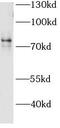 FACL4 antibody, FNab00108, FineTest, Western Blot image 
