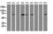E3 ubiquitin-protein ligase MGRN1 antibody, NBP2-00586, Novus Biologicals, Western Blot image 