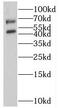 Somatostatin receptor type 5 antibody, FNab08255, FineTest, Western Blot image 