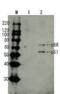 HIV-1 Env gp41 antibody, 65-003, BioAcademia Inc, Western Blot image 