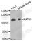 N-Acetyltransferase 10 antibody, A5988, ABclonal Technology, Western Blot image 