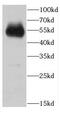 Acidic Residue Methyltransferase 1 antibody, FNab01130, FineTest, Western Blot image 