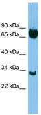 SRY-Box 13 antibody, TA334240, Origene, Western Blot image 