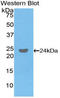 FcRIIIb antibody, LS-C293848, Lifespan Biosciences, Western Blot image 