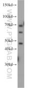 Alpha-N-acetylgalactosaminidase antibody, 15096-1-AP, Proteintech Group, Western Blot image 
