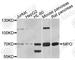 Myeloperoxidase antibody, A1374, ABclonal Technology, Western Blot image 