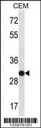 Small Nuclear Ribonucleoprotein Polypeptide A antibody, 57-972, ProSci, Western Blot image 