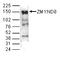 Zinc Finger MYND-Type Containing 8 antibody, TA347318, Origene, Western Blot image 