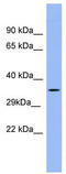 Pregnancy Specific Beta-1-Glycoprotein 5 antibody, TA346331, Origene, Western Blot image 
