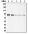 REL Proto-Oncogene, NF-KB Subunit antibody, LS-C352767, Lifespan Biosciences, Western Blot image 