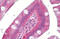 Mitogen-Activated Protein Kinase 9 antibody, MBS244977, MyBioSource, Immunohistochemistry paraffin image 
