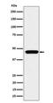 MAPK Activated Protein Kinase 3 antibody, M04510, Boster Biological Technology, Western Blot image 