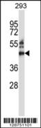 Zinc Finger Protein 660 antibody, 57-652, ProSci, Western Blot image 