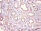 Dehydrogenase/Reductase 9 antibody, A53477-100, Epigentek, Immunohistochemistry paraffin image 