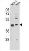 Zinc Finger Protein 384 antibody, AP54697PU-N, Origene, Western Blot image 
