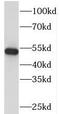 Phosphatidylinositol 4-Kinase Type 2 Beta antibody, FNab06425, FineTest, Western Blot image 