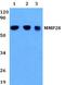 Matrix Metallopeptidase 28 antibody, A07364, Boster Biological Technology, Western Blot image 