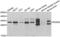 Platelet Derived Growth Factor Subunit B antibody, LS-C331340, Lifespan Biosciences, Western Blot image 
