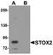 Storkhead Box 2 antibody, orb75528, Biorbyt, Western Blot image 