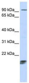 Mitochondrial Ribosomal Protein L58 antibody, TA335013, Origene, Western Blot image 