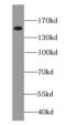 EPH Receptor A1 antibody, FNab02801, FineTest, Western Blot image 