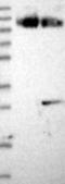 Mitochondrial import inner membrane translocase subunit Tim23 antibody, NBP1-80680, Novus Biologicals, Western Blot image 