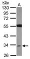 Short Chain Dehydrogenase/Reductase Family 16C Member 5 antibody, NBP2-20277, Novus Biologicals, Western Blot image 