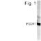 Retinol Dehydrogenase 11 antibody, PA1-4231, Invitrogen Antibodies, Western Blot image 