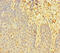 LIM Domain Only 2 antibody, CSB-PA013009HA01HU, Cusabio, Immunohistochemistry paraffin image 