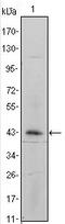 Integrin Subunit Alpha 5 antibody, AM06388SU-N, Origene, Western Blot image 