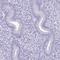 Spermatid Associated antibody, HPA039359, Atlas Antibodies, Immunohistochemistry paraffin image 