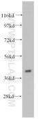GIPC PDZ Domain Containing Family Member 1 antibody, 14822-1-AP, Proteintech Group, Western Blot image 