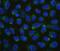 V-set domain-containing T-cell activation inhibitor 1 antibody, A02821-3, Boster Biological Technology, Immunofluorescence image 
