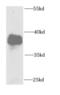 FA Complementation Group L antibody, FNab03010, FineTest, Western Blot image 