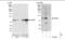 90 kDa ribosomal protein S6 kinase 4 antibody, NBP1-46187, Novus Biologicals, Immunoprecipitation image 