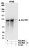 Cell Cycle Associated Protein 1 antibody, A303-881A, Bethyl Labs, Immunoprecipitation image 