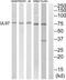 Cytomegalovirus UL97 antibody, PA5-39565, Invitrogen Antibodies, Western Blot image 