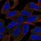 Solute Carrier Family 44 Member 5 antibody, NBP2-30814, Novus Biologicals, Immunocytochemistry image 