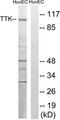 Dual specificity protein kinase TTK antibody, TA314651, Origene, Western Blot image 